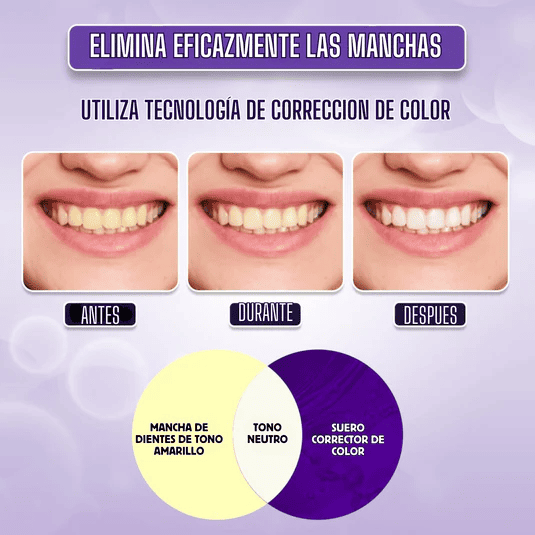 🔥 Hismile V34 - La Solución Definitiva Para Una Sonrisa Radiante 🔥