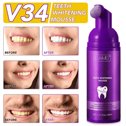 🔥 Hismile V34 - La Solución Definitiva Para Una Sonrisa Radiante 🔥